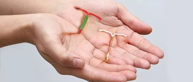 Mengenal Lebih Jauh Tentang IUD. Kok Bisa Sampai Ada Bayi Terlahir dengan Mengenggam Alat Kontrasepsi Ini? 8