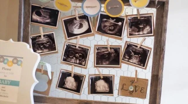 11 Dekorasi Baby Shower Lucu dan Menggemaskan. Menanti Kelahiran dengan Sedikit Berpesta Kenapa Tidak? 19