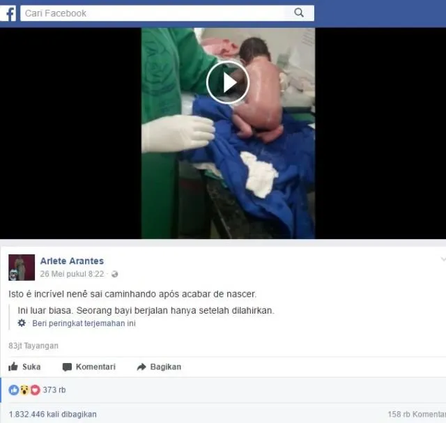 Viral! Sebuah Video Perlihatkan Bayi yang Baru Saja Lahir Mampu Berjalan Kaki, Ini Penjelasannya 5