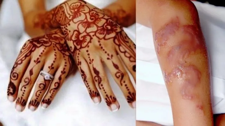 7 Cara Bedakan Henna Abal-abal dengan yang Asli Natural. Hati-hati, Kamu Bisa Aja Punya Alergi