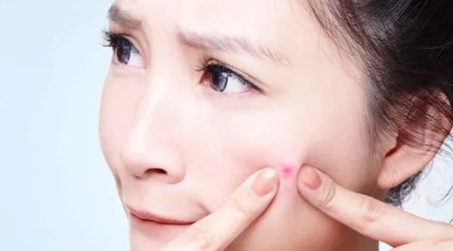 Mengenal Lebih Jauh Tentang IUD. Kok Bisa Sampai Ada Bayi Terlahir dengan Mengenggam Alat Kontrasepsi Ini? 11