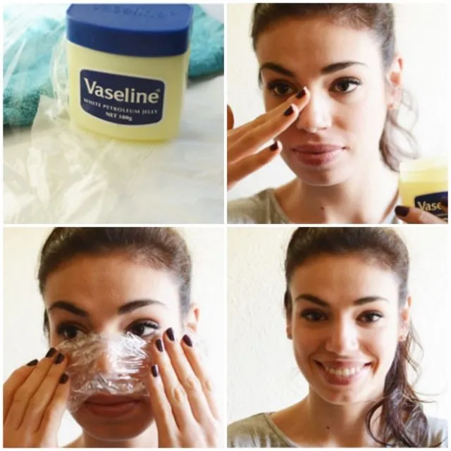 7 Ramuan Alami yang Ampuh Atasi Komedo Membandel, Wajah Mulus Tanpa Harus Facial 9