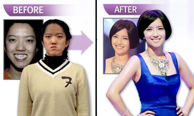 Bukan Pengen Mirip Artis Doang, Ternyata Banyak Orang Korea Itu Operasi Plastik Demi Tuntutan Kerja 9