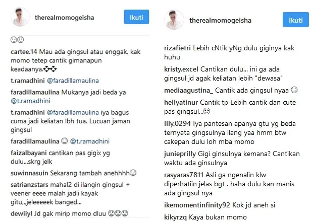 Telah Hilang Gigi Gingsulnya Momo Geisha, Lebih Cantik Nggak? Yang Pasti Doi Jadi Lebih Suka Senyum 8