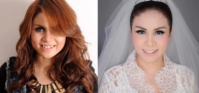Telah Hilang Gigi Gingsulnya Momo Geisha, Lebih Cantik Nggak? Yang Pasti Doi Jadi Lebih Suka Senyum 5