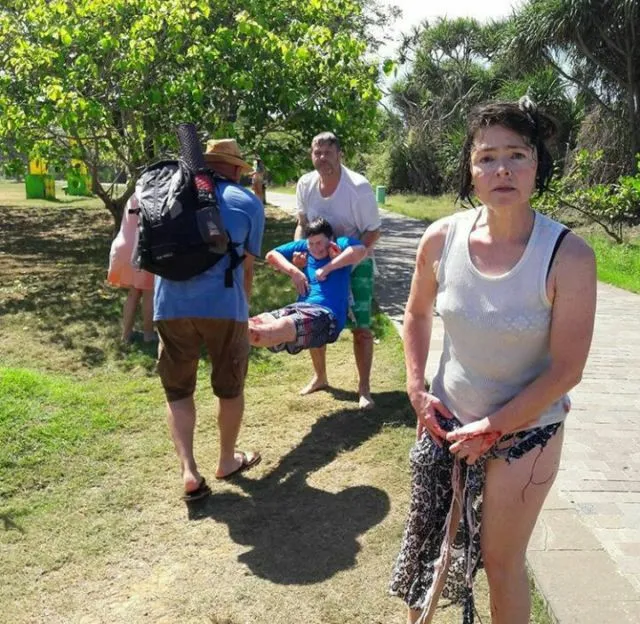 Gara-gara Foto Selfie, Wisatawan Terluka Parah Akibat Terhantam Ombak Besar di Water Blow, Bali! 4