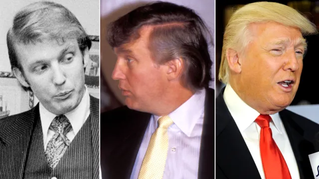 Misteri di Balik Rambut Donald Trump Terungkap! Saking Seringnya Diomongin, Para Ahli Angkat Bicara 18