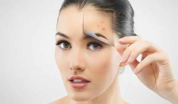 7 Manfaat Cuka Apel untuk Kulit Wajah. Jerawat Hingga Kerutan Punah! 9