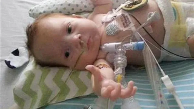 Kisah Bayi Mungil Adam Begitu Mengharukan. Ini Fakta yang Mesti Kamu Tahu Soal Penyakitnya 8