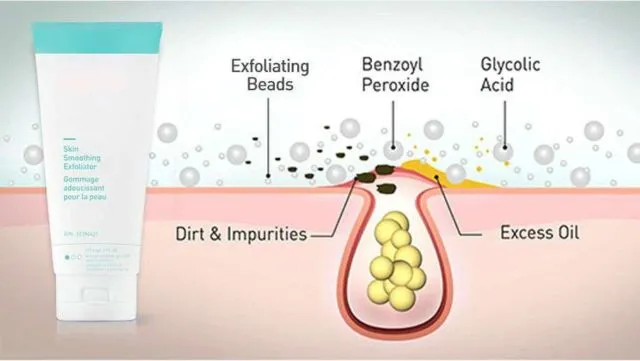 8 Kandungan di Dalam Kosmetik Anti Jerawat. Pelajari Khasiatnya Agar Kulitmu Makin Terawat 11