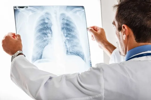 Bayi Meninggal Kena Pneumonia Berat Akibat Asap Rokok. Sampai Kapan Hal Ini Akan Terus Terulang? 7