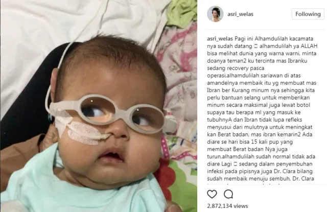 Anak Asri Welas Terkena Katarak di Usianya yang Baru 3 Bulan. Kita Doakan Agar Cepat Sembuh Yuk 8
