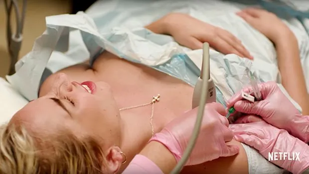 Lady Gaga Mengaku Mengidap Fibromyalgia, Nggak Main-main Penyakit Ini Sungguh Menyiksa Lho 7