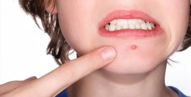 5 Ciri- Ciri Skincare Tidak Cocok di Kulit Kamu 10