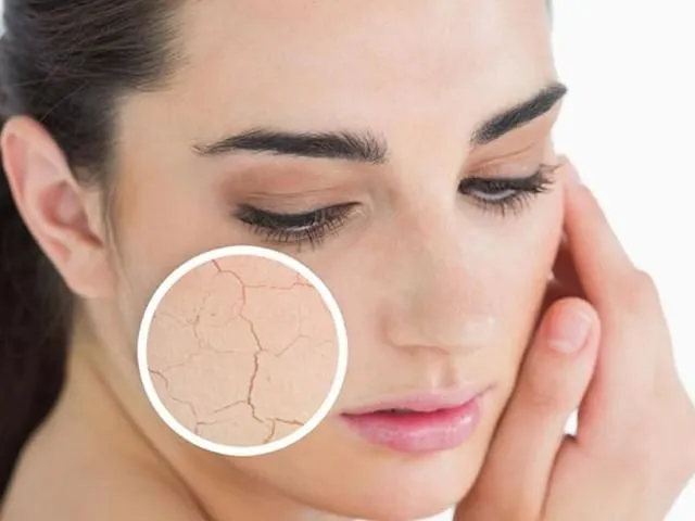 5 Ciri- Ciri Skincare Tidak Cocok di Kulit Kamu 8