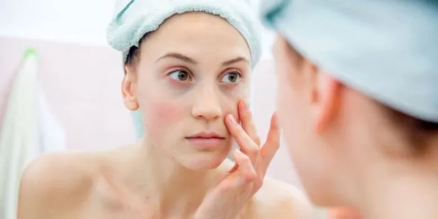 5 Ciri- Ciri Skincare Tidak Cocok di Kulit Kamu 7 Ciri Skincare Tidak Cocok