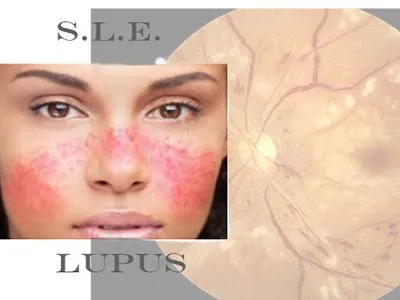 Transplantasi Ginjal Dari Raisa Buat Selena Gomez: Wujud Nyata Pengorbanan Sahabat. Salut! 5