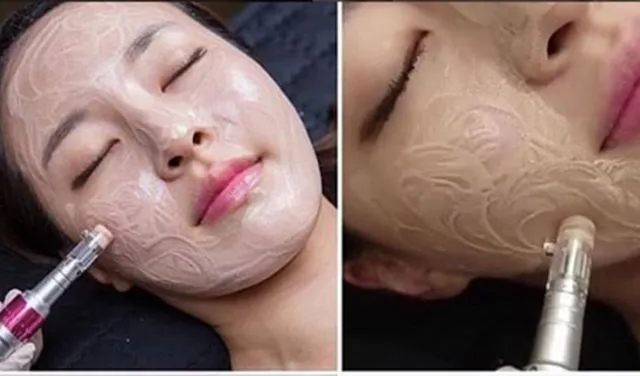 Sulam Bedak, Bikin Wajah Mulus Bercahaya Bak Bintang Korea. Aman Nggak, Ya? 5