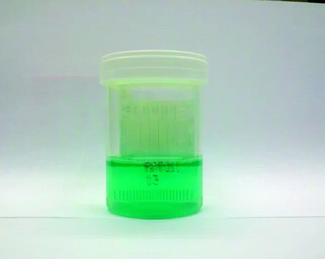 Waspadai Kesehatanmu dari 7 Jenis Warna Urine Ini. Mulai Tanda Dehidrasi Hingga Gejala Lever Dibahas di Sini 14