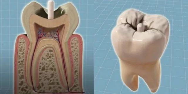 Gigi Berlubang Bisa Tumbuh Kembali dengan Obat Ini. Tak Perlu Ditambal 4