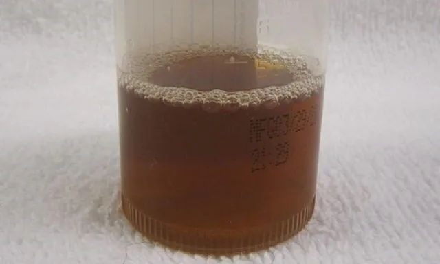 Waspadai Kesehatanmu dari 7 Jenis Warna Urine Ini. Mulai Tanda Dehidrasi Hingga Gejala Lever Dibahas di Sini 11