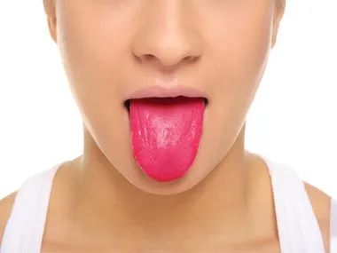 Jangan Remehkan Perubahan Warna Lidah Kamu! Bisa Jadi Itu Indikasi Awal dari Penyakit-Penyakit Ini 8