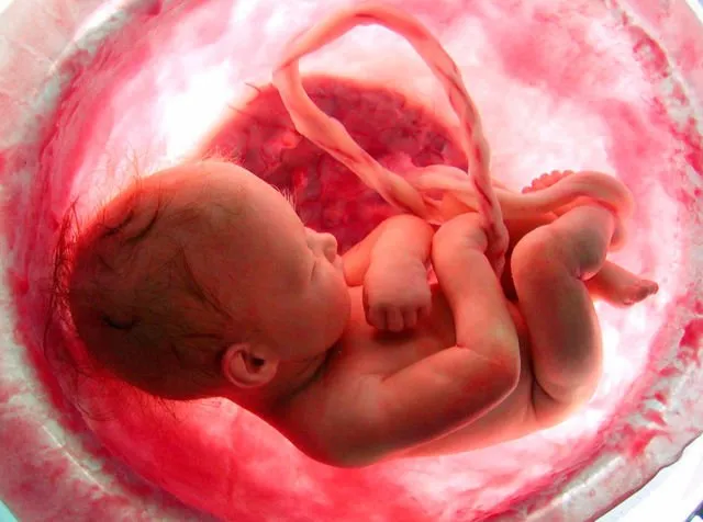 Transplantasi Rahim Janjikan Harapan Baru. Yang Divonis Tidak Akan Bisa Hamil, Kini Punya Jawaban 6