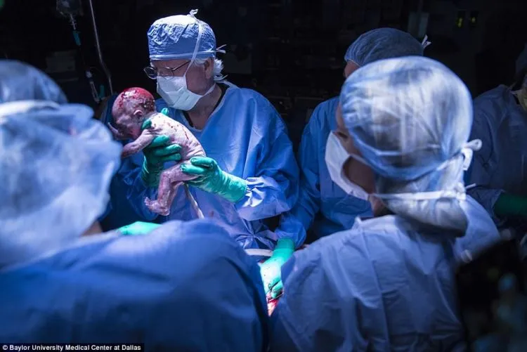 Transplantasi Rahim Janjikan Harapan Baru. Yang Divonis Tidak Akan Bisa Hamil, Kini Punya Jawaban 7