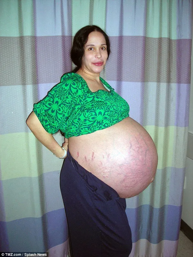 Sempat Viral Sejak Hamil 8 Anak Kembar, Kini 'Octomom' Ini Telah Berdamai dengan Kehidupannya 6