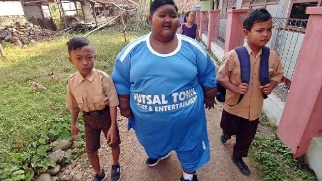 Yudi, Penderita Obesitas Meninggal Dunia. Sudah Saatnya Permasalahan Ini Jadi Perhatian Bersama 6