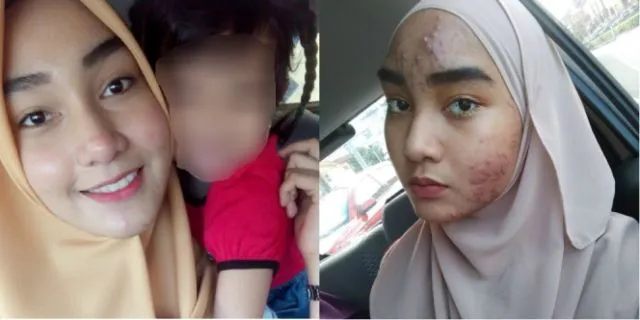 Pengen Punya Fisik Sempurna, 7 Usaha Mempercantik Diri Ini Malah Berujung Petaka. Makanya Bersyukur! 8