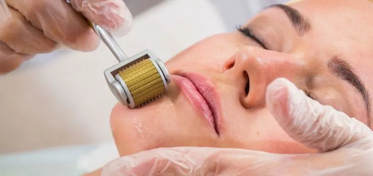 Menghilangkan Bopeng dan Bekas Jerawat Kini Bukan Lagi Mimpi. Vampire Facial Salah Satu Solusinya! 13