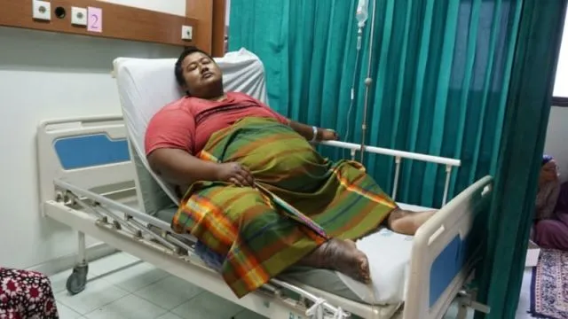 Yudi, Penderita Obesitas Meninggal Dunia. Sudah Saatnya Permasalahan Ini Jadi Perhatian Bersama 5