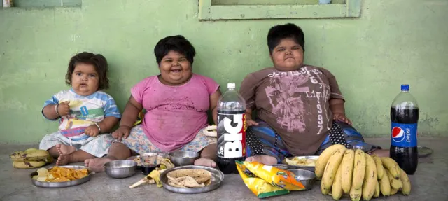 Yudi, Penderita Obesitas Meninggal Dunia. Sudah Saatnya Permasalahan Ini Jadi Perhatian Bersama 8