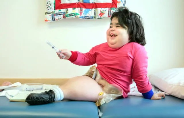 Bayi di India Lahir dengan Kaki Menyatu Mirip Putri Duyung. Ternyata Sindrom Ini Penyebabnya 8