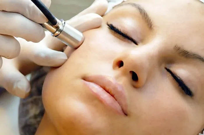 Menghilangkan Bopeng dan Bekas Jerawat Kini Bukan Lagi Mimpi. Vampire Facial Salah Satu Solusinya! 15