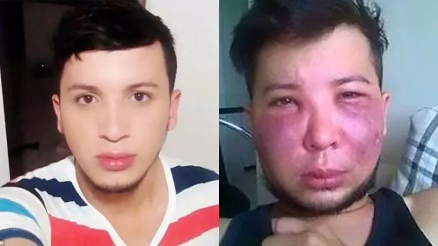Pengen Punya Fisik Sempurna, 7 Usaha Mempercantik Diri Ini Malah Berujung Petaka. Makanya Bersyukur! 12