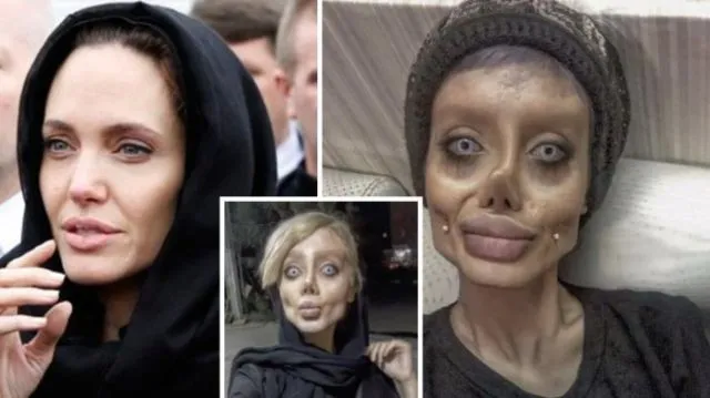 Pengen Punya Fisik Sempurna, 7 Usaha Mempercantik Diri Ini Malah Berujung Petaka. Makanya Bersyukur! 14