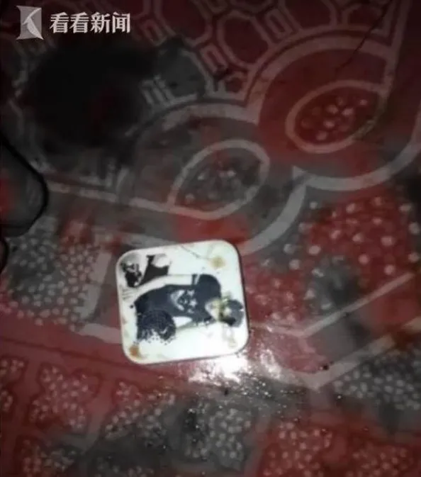 Bocah Ini Alami Ledakan Serius Saat Memainkan MP3 Player Seharga Rp37 Ribu. Harap Hati-Hati, Guys! 5
