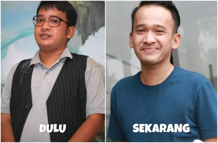 Melihat Proses Perubahan 8 Seleb dalam Usahanya Mempercantik Penampilan. Bisa Ditiru nih Semangatnya 14