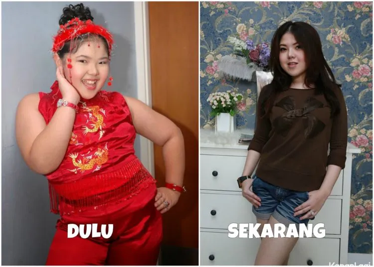 Melihat Proses Perubahan 8 Seleb dalam Usahanya Mempercantik Penampilan. Bisa Ditiru nih Semangatnya 12
