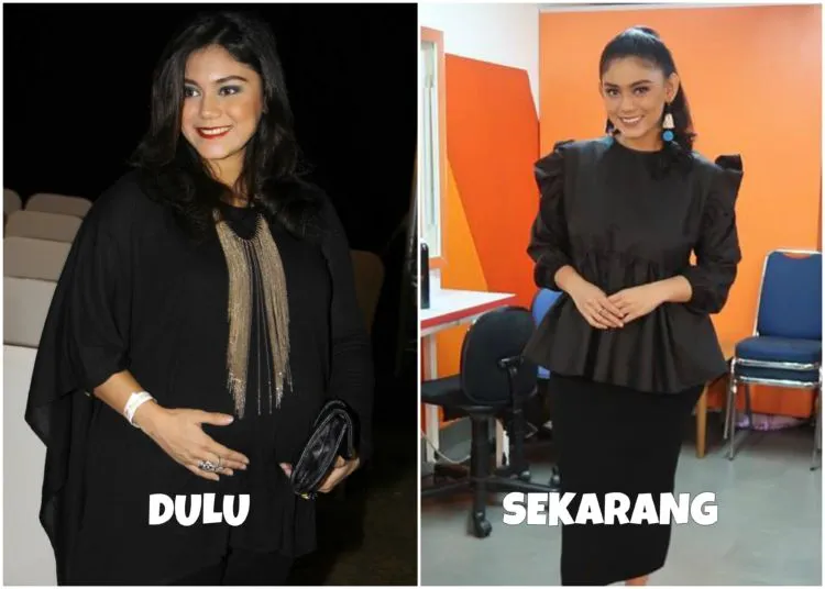 Melihat Proses Perubahan 8 Seleb dalam Usahanya Mempercantik Penampilan. Bisa Ditiru nih Semangatnya 11