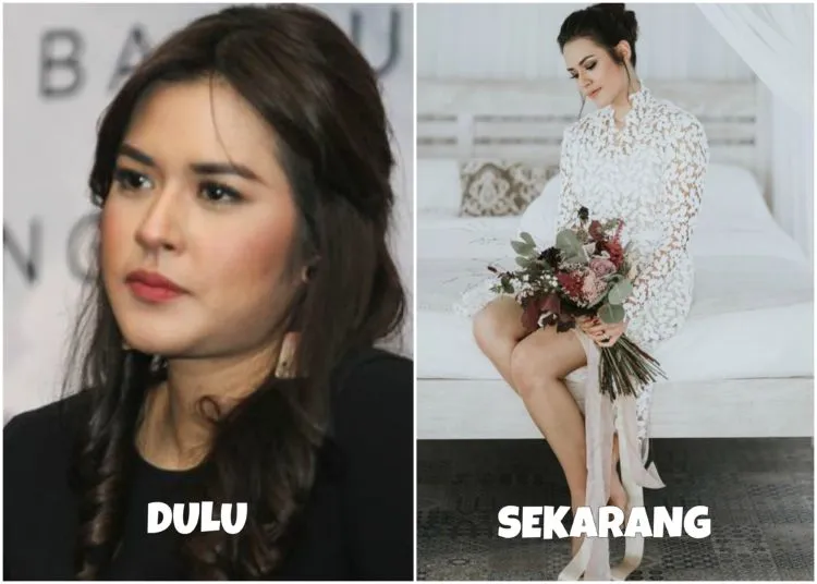 Melihat Proses Perubahan 8 Seleb dalam Usahanya Mempercantik Penampilan. Bisa Ditiru nih Semangatnya 16