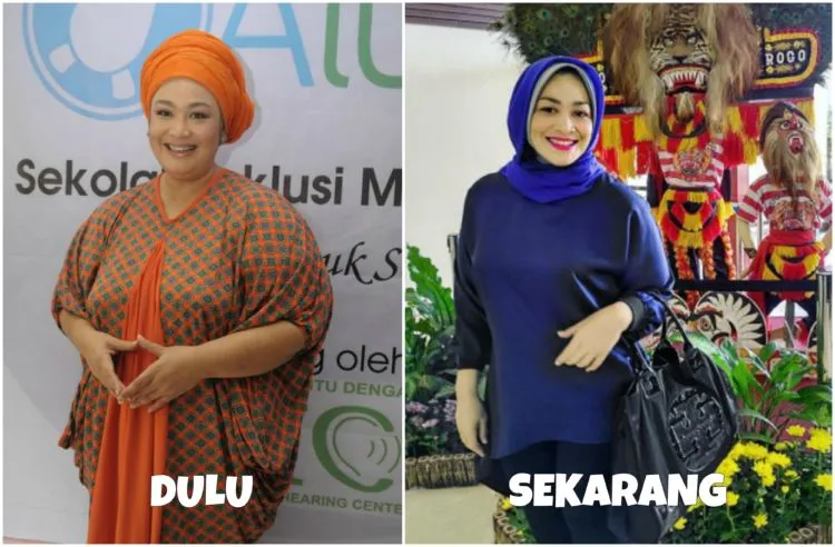Melihat Proses Perubahan 8 Seleb dalam Usahanya Mempercantik Penampilan. Bisa Ditiru nih Semangatnya 15