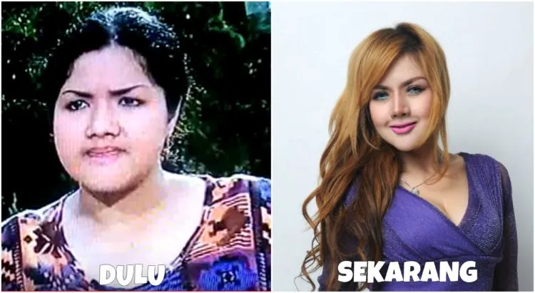 Melihat Proses Perubahan 8 Seleb dalam Usahanya Mempercantik Penampilan. Bisa Ditiru nih Semangatnya 9