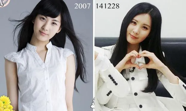 Transformasi 'Wow' 10 Bintang K-Pop Saat Debut dan Setelah Terkenal. Kaget sama Perubahannya Nggak? 17