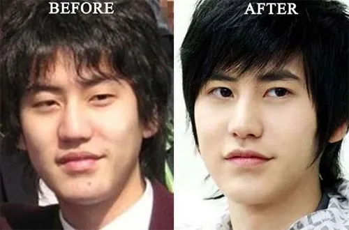 Transformasi 'Wow' 10 Bintang K-Pop Saat Debut dan Setelah Terkenal. Kaget sama Perubahannya Nggak? 19