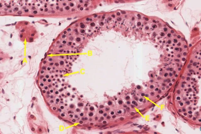 Azoospermia, Kelainan Pada Sperma Cowok yang Bikin Sulit Menghamili. Waspada Meski Nggak Mengalami 8
