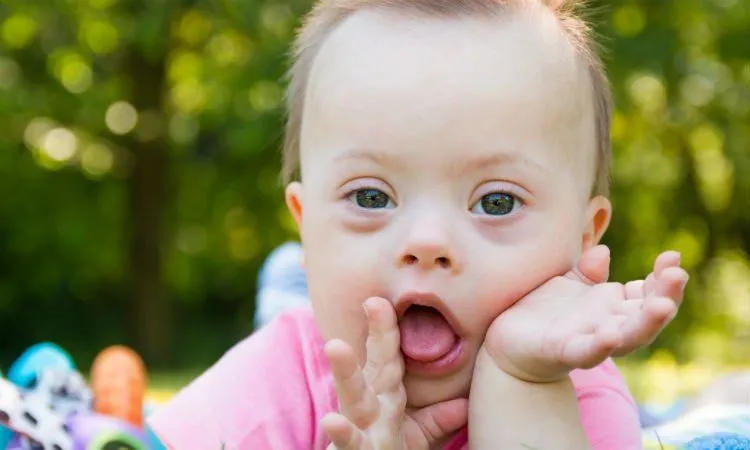 14 Fakta Down Syndrome yang Bukan Cuma Para Ibu, Tapi Semua Orang Wajib Tahu #LotsOfSocks 25