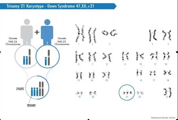 14 Fakta Down Syndrome yang Bukan Cuma Para Ibu, Tapi Semua Orang Wajib Tahu #LotsOfSocks 16